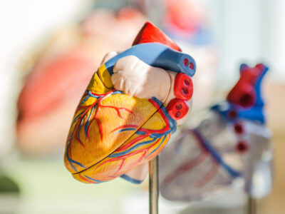 Kardiomiopatia rozstrzeniowa – ICD w prewencji pierwotnej SCD: trudne decyzje