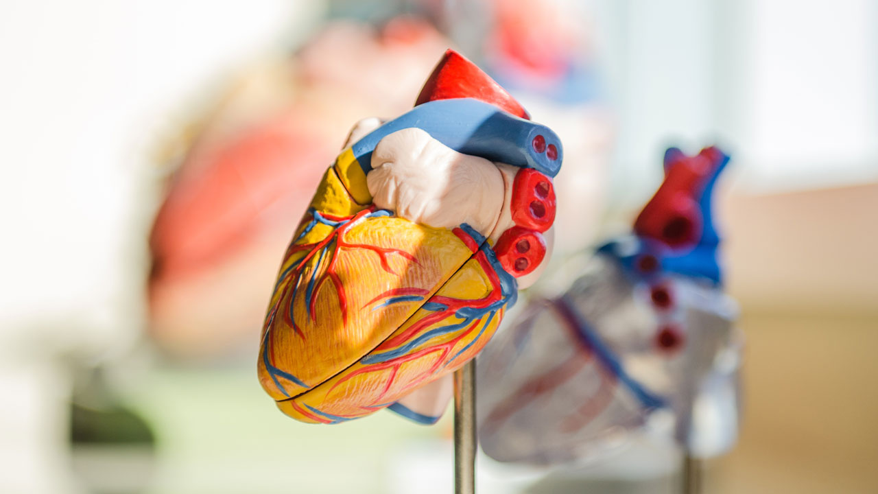 Kardiomiopatia rozstrzeniowa – ICD w prewencji pierwotnej SCD: trudne decyzje